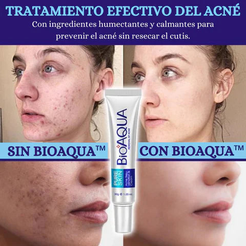 BIOAQUA - Gel natural Eliminadora de acné y cicatrices