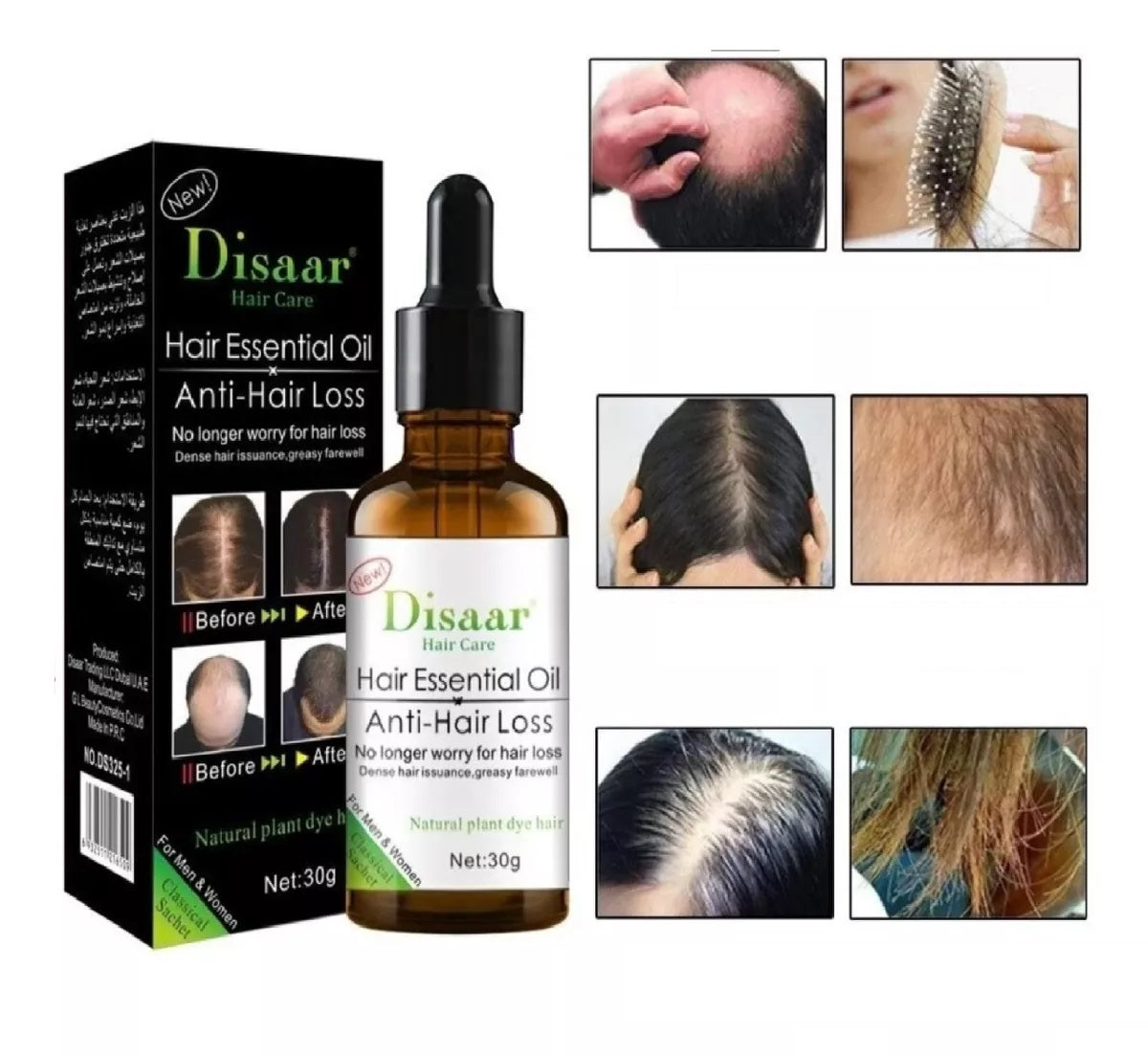 SUPER OFERTA ( PAGA 1 Y LLEVA 2) - Anticaída Cabello Aceite , Alopecia Calvicie