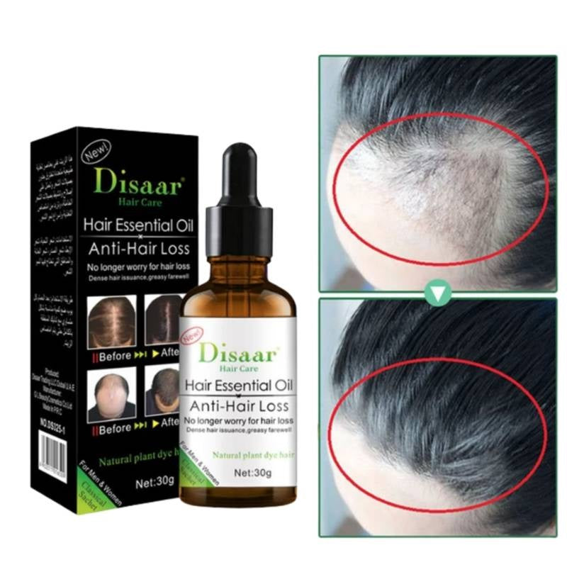 SUPER OFERTA ( PAGA 1 Y LLEVA 2) - Anticaída Cabello Aceite , Alopecia Calvicie
