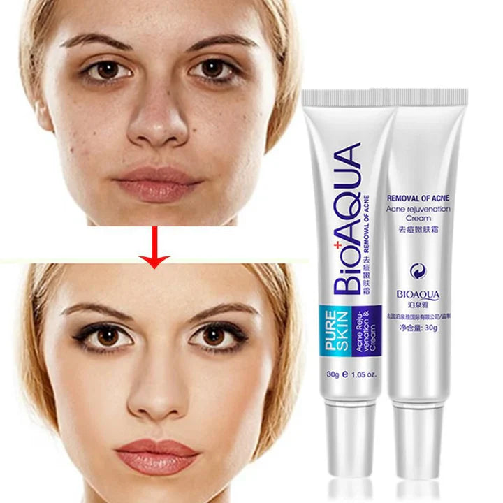 BIOAQUA - Gel natural Eliminadora de acné y cicatrices