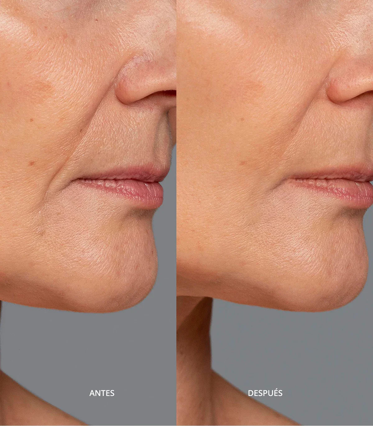 3 x 1 ( Paga 1 y lleva 2 ) Crema correctora BIOAOUA BB con pulpa cruda de arroz