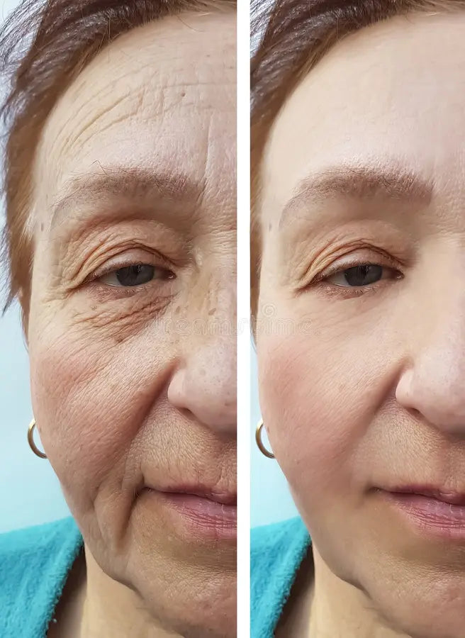 Capsula Hidratante De Colágeno Para El Cuidado Facial 32 Cap