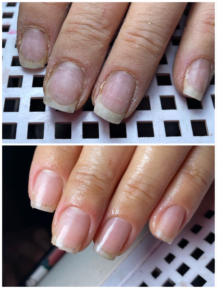 Kit de manicura NailGlam™
