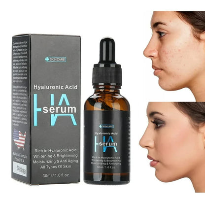 Serum Facial Acido Hialuronico 30ml